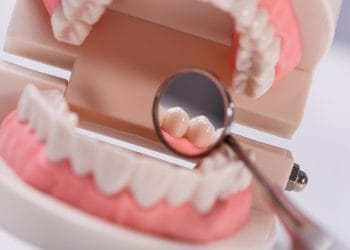 Tips Ampuh Menjaga Kesehatan Gigi Anak